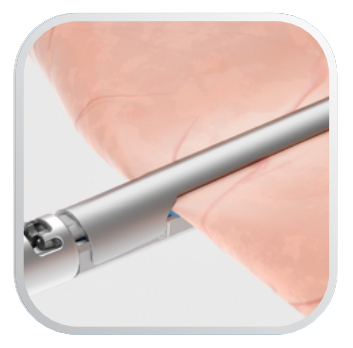 axon medical solutions ireach magunm